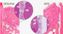 REGEDENT Literaturübersicht Hyaluronsäure 2021 PIP