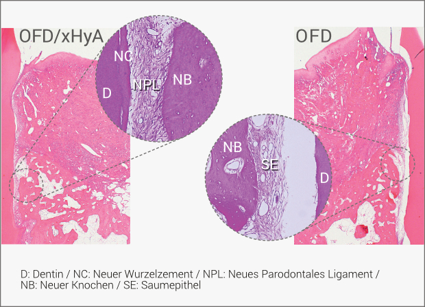 Chirurgische PA-Therapie