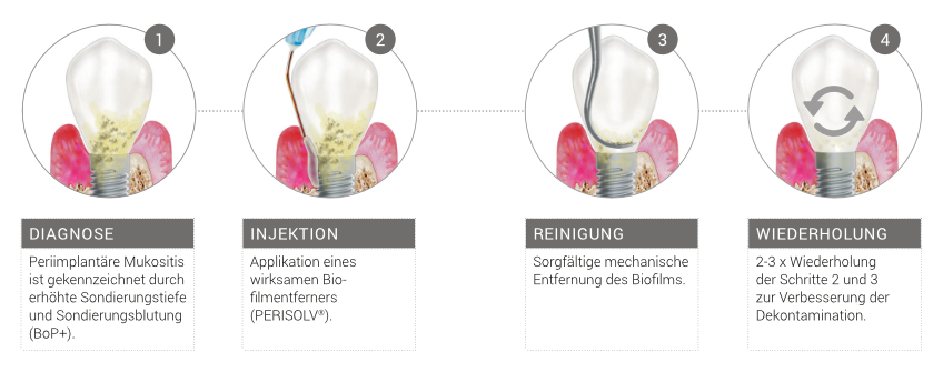 Bild Ablauf Clean & Seal