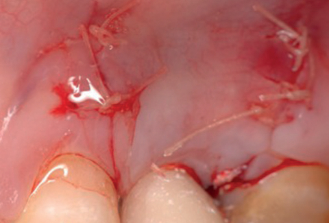 Wund- und Gewebeheilung