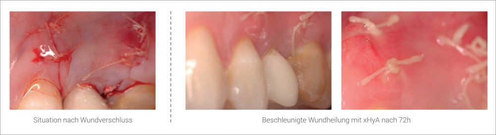 Wund- und Gewebeheilung