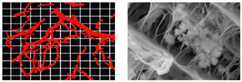 Bild Regedent OSSIX BONE Vorteile