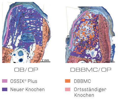 Bild Regedent OSSIX BONE Vorteile