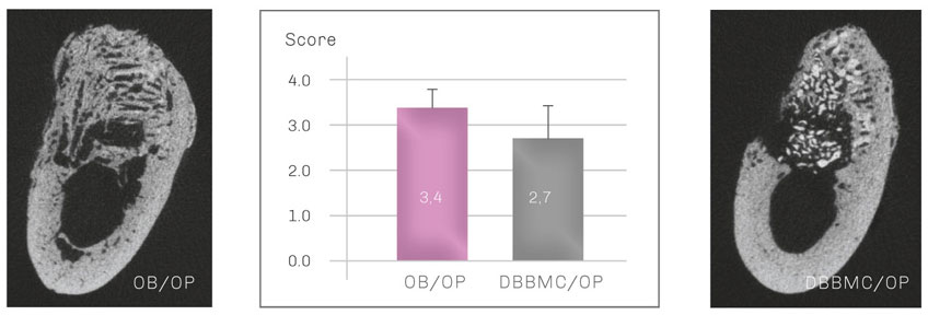Bild Regedent OSSIX BONE Vorteile
