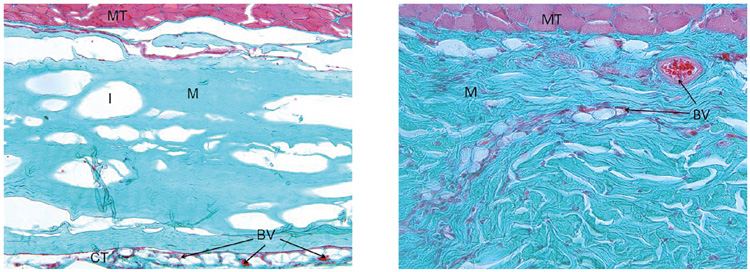 Bild SMARTBRANE Vorteile