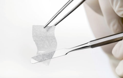 Bild SMARTBRANE Vorteile