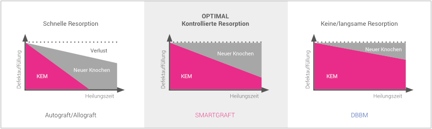 Regedent SMARTGRAFT Produkt Vorteile